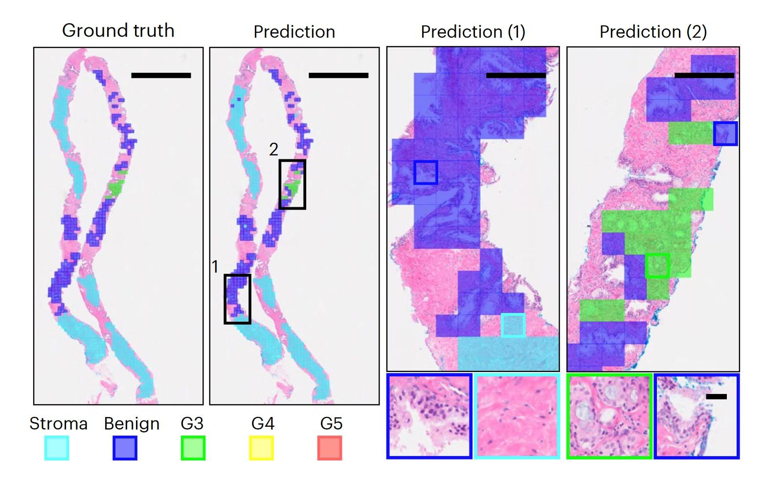 What AI can tell us about microscope slides